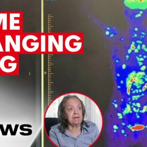 Game-changing drug for Australians suffering from stomach and oesophageal cancer | 7NEWS